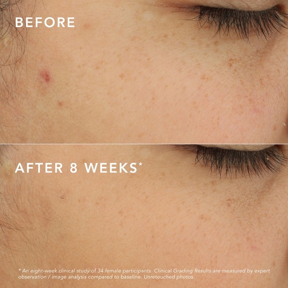 SeneGence C-Bright Dark Spot Corrector - Picture 4 of 7